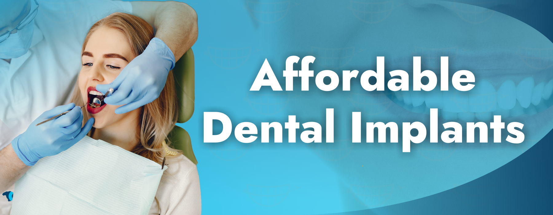 Best Affordable Dental Implants: Quality Options for Every Budget