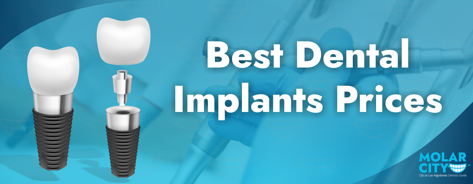 Best Price for Dental Implants: Top Brands and Affordable Options