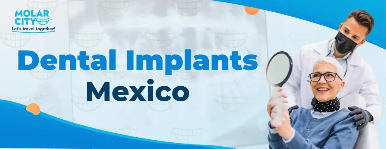 Dental Implants Mexico Dental Implants Mexico