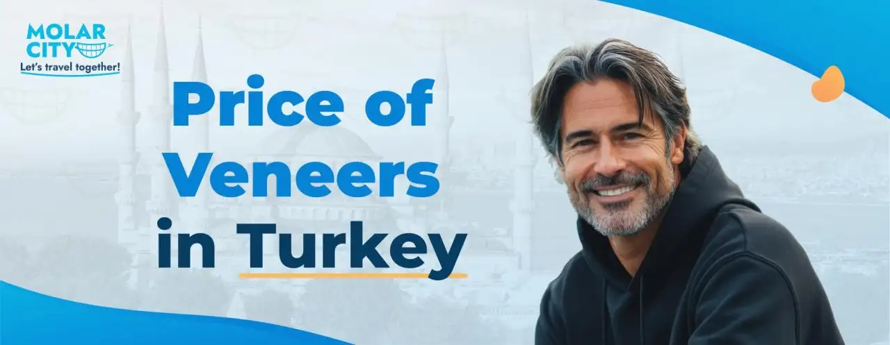 Price of Veneers in Turkey Price of Veneers in Turkey