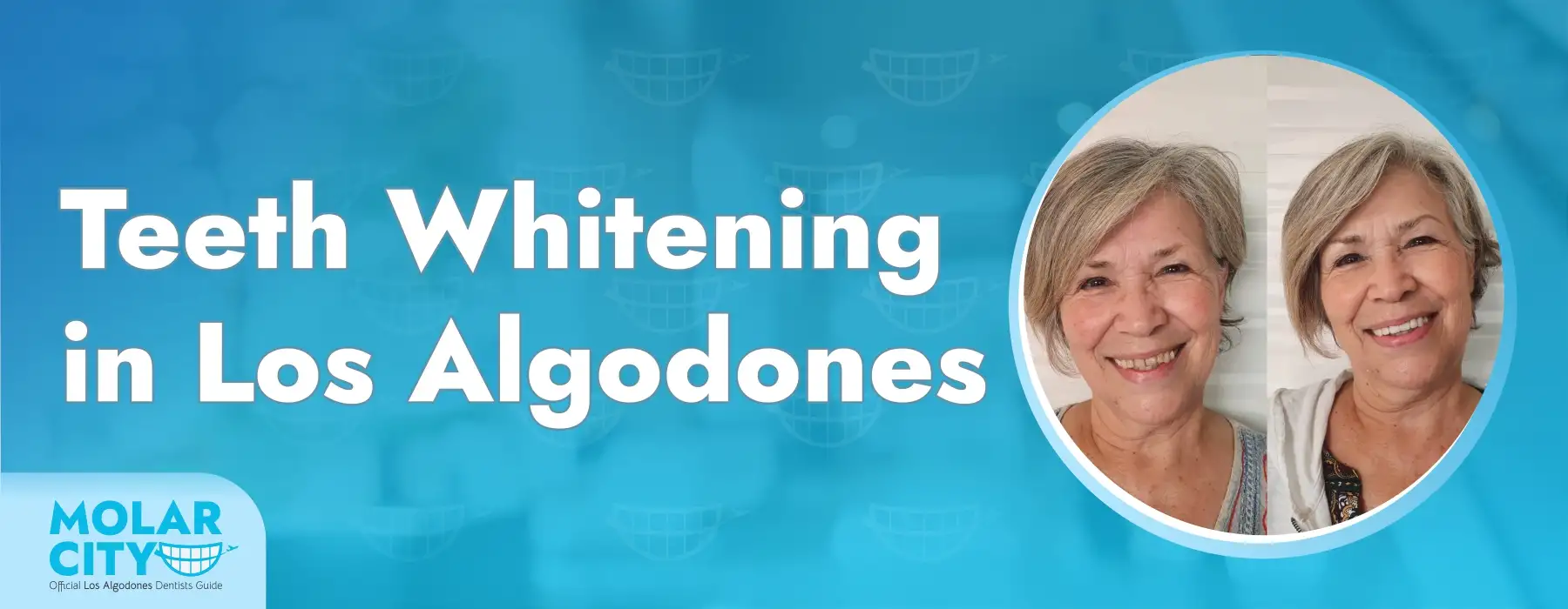 Teeth Whitening in Los Algodones